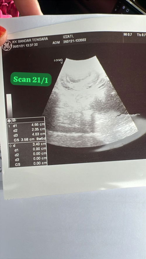 Ada mommy2 yang pernah alami tak???Why begini scan nya ya..aduh pening kitaa…