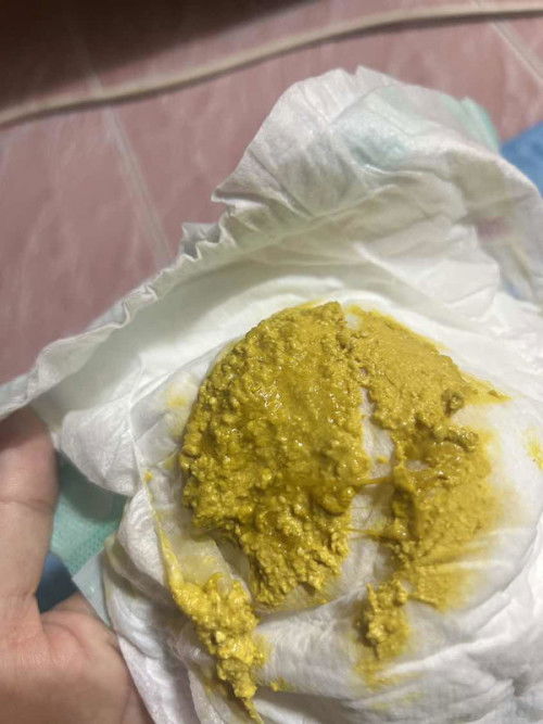 น้องวัย14วันอึเป็นแบบนี้