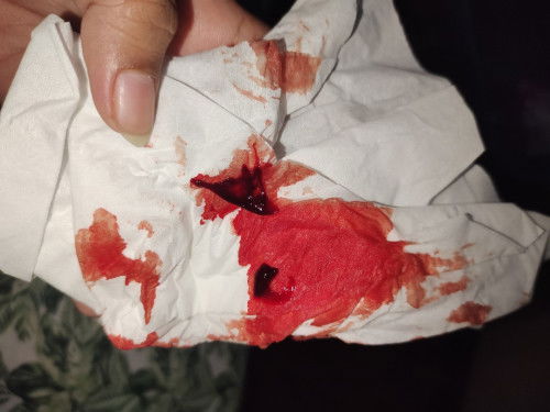 ada yang pernah ngalamin?