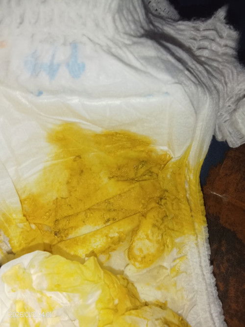 Bun bayi ku 1 bulan 25 hari pup nya ad busa tp masih ad serat ny, bab 3-4 kli sehari nrml GK Bun