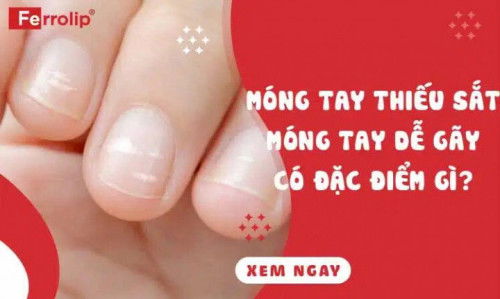 Móng tay thiếu sắt trông như thế nào?