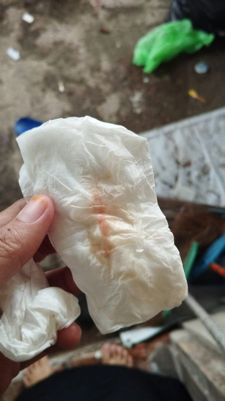 Flek warna coklat pink