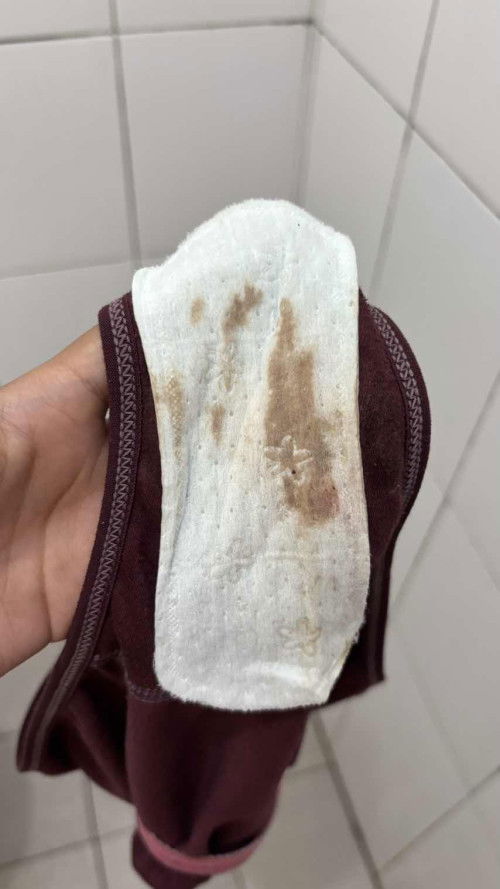 Flek coklat usia 4 minggu