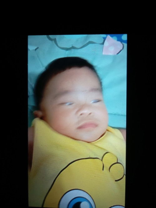 ลูกทำตาขาว