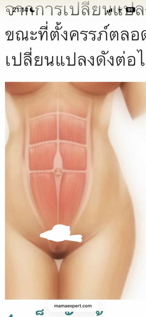 ท้องแข็งตรงส่วนล่าง