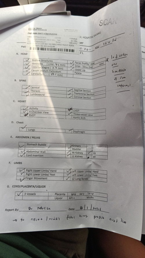 Jantina lelaki atau perempuan