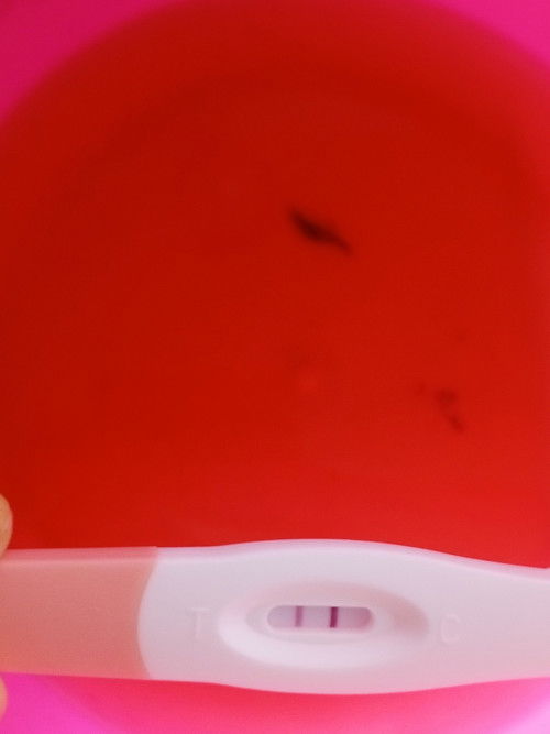 Adakah normal mamy semua kita dh bt scan ap semua tpi klinik bgthu kita Gugur then gi hptal kata