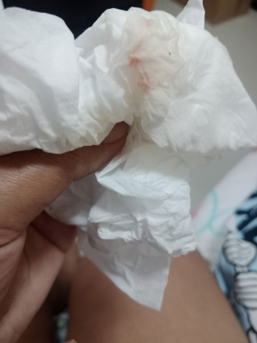 มีเลือดออก