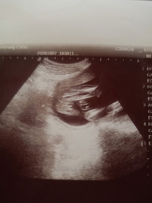 ช่วยดูเพศลูกหน่อยค่ะ🙏