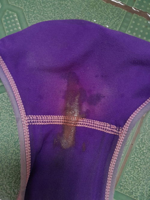 Darah Implantasi Atau Darah Haid?