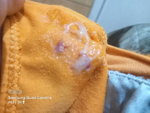 Need na po ba pumunta nang hospital kapag ganito na discharge? 40 weeks and 2 days