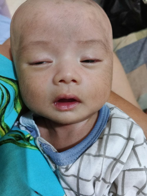 Bayi sering tidur dan kurang minum susu