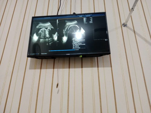 USG & HPL APRIL 2026