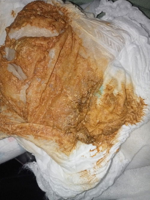 สีอุจจาระของลูก