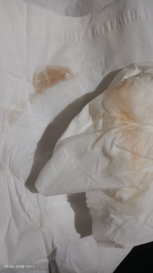 Flek setelah HB (usia kandungan 9week)