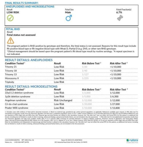 NIPT Panorama ตรวจ Microdeletion มีผล Angelman : Risk Unchanged