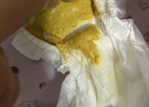 เด็กแรกเกิดอายุ14วัน