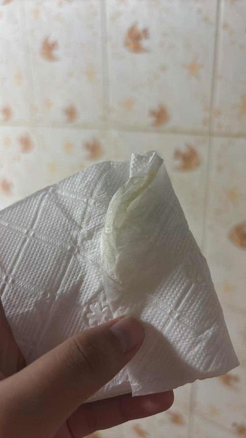 แบบนี้ปกติมั้ยคะแม่ๆ