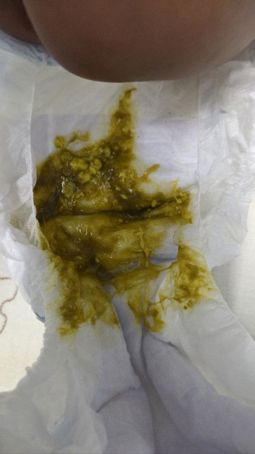 Najis baby warne gelap