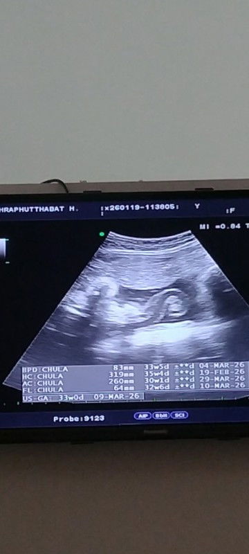 เจ้าตัวน้อยไม่ให้ดูหน้า