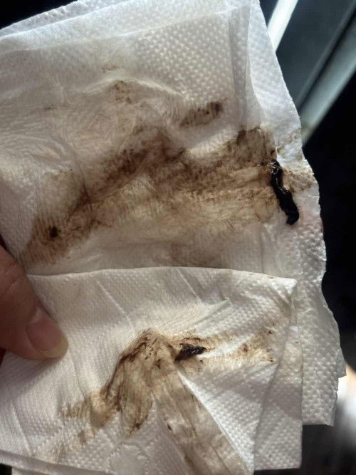 มีเลือดออก และมีลิ่มเลือด