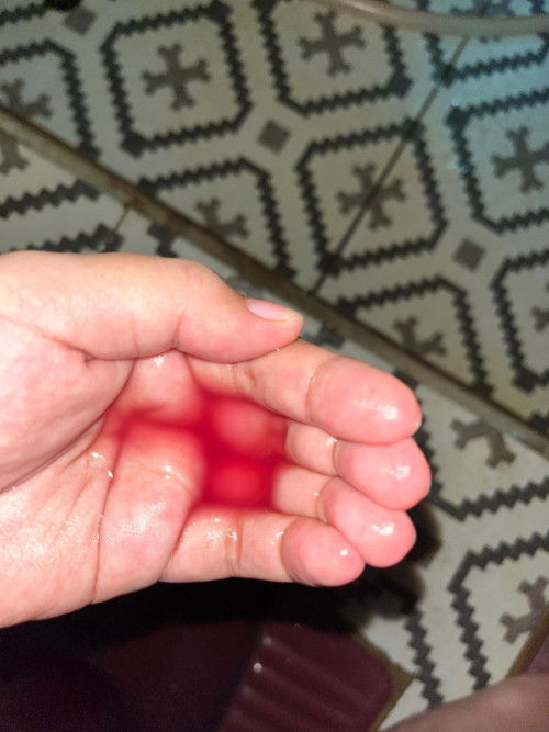 Air kencing warna merah