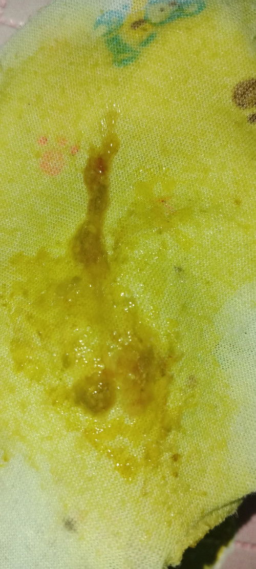 Apakah ini berbahaya bund