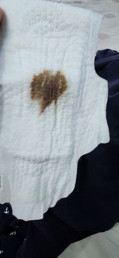 Sape prgnant  Trismster 1,ade kluar spotting warna coklat. Boleh share x.. Sy buntu n tlg sgt2