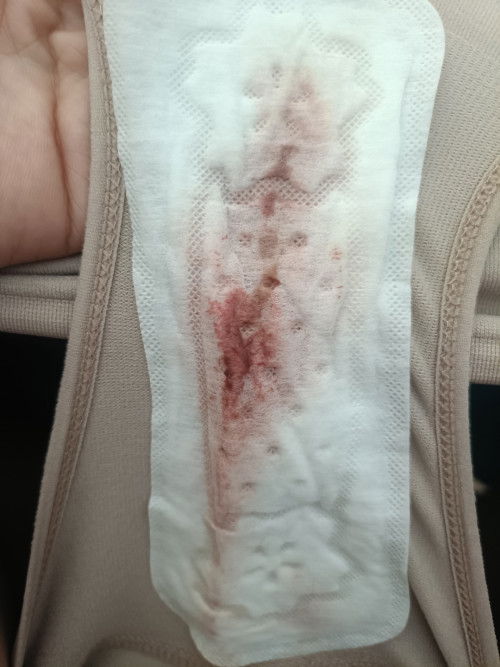 เลือดออกแบบนี้ปกติ หรืออันตรายไหม