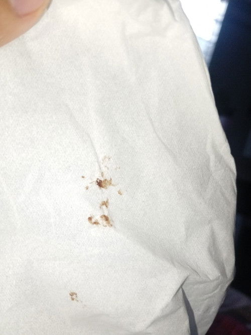 Bun dsini ada gak hamil 4week keluar flek seperti ini tapi tidak nyeri perut tidak kram