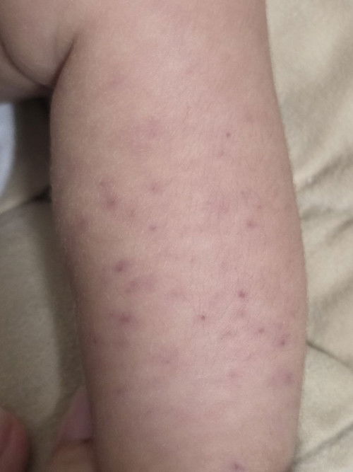 Dots on the left leg