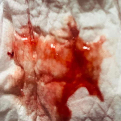 ท้อง 7 สัปดาห์