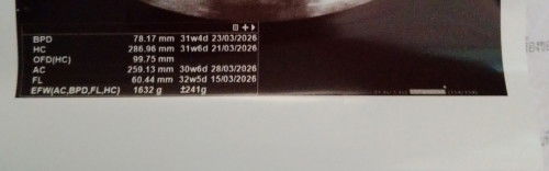 แม่พึ่งรู้??!! (ในใบอัลตราซาวด์)