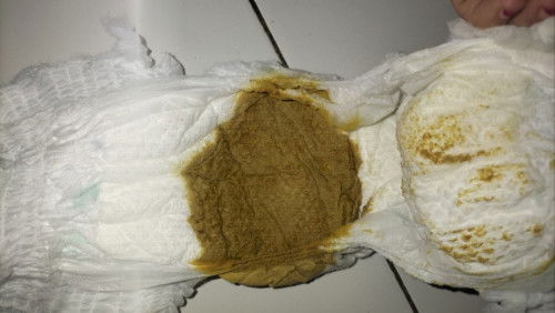 Anak umur 2 bulan pup nya cair