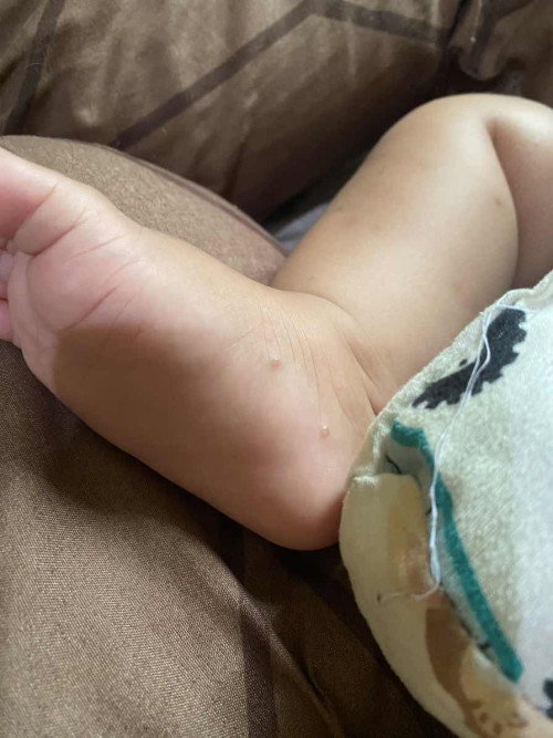 Kulit bayi