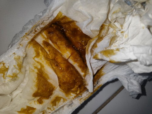 Mau tanya dong bunda bunda, maaf ya fotonya agak jorok