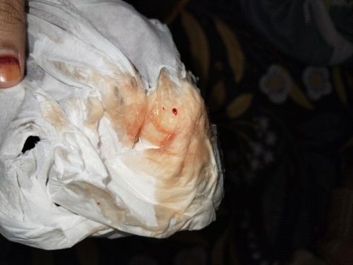 Darah di kehamilan 7 week