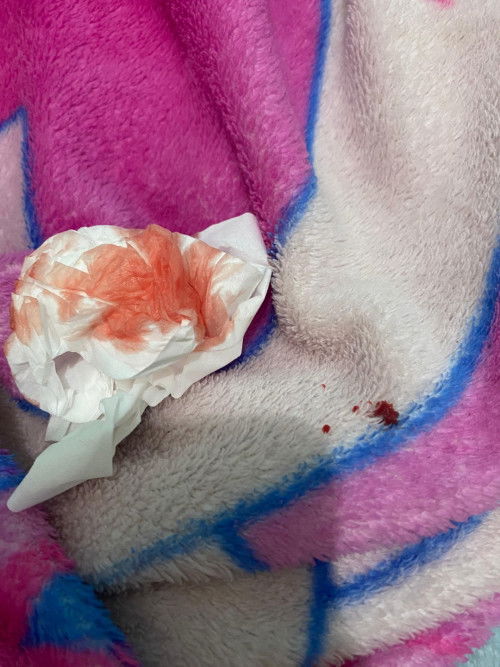 Darah keluar saat hamil muda