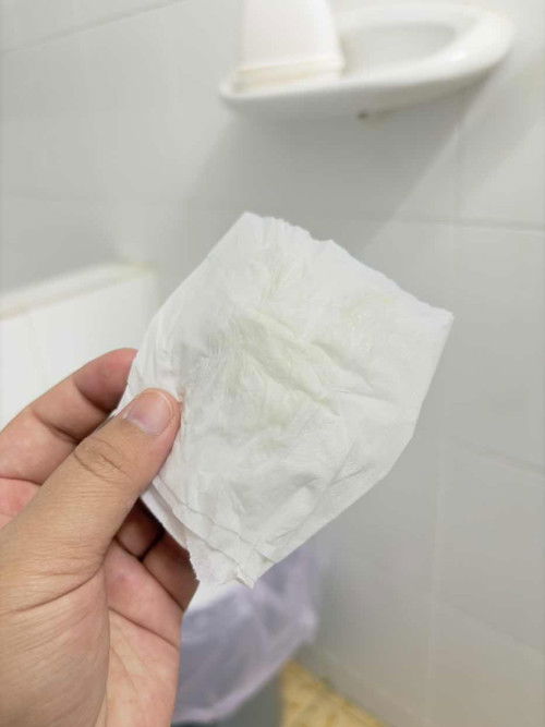 มีมูกแบบนี้ปกติมั้ย