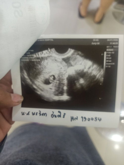 อยากทราบว่าเจอน้องรึป่าวค่ะ