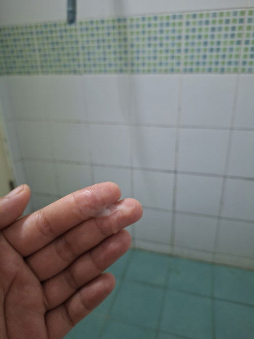 มูกใสอีกกี่วันคลอด