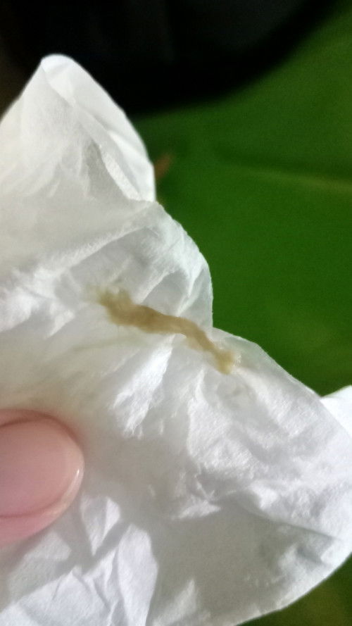 Flek atau keputihan ya ?