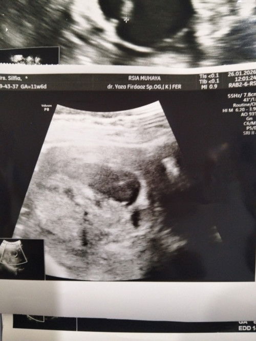 Pamit ya bunda"👋🏻