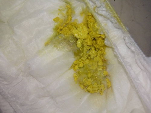 Tentang bayi 2 bulan 30 hari