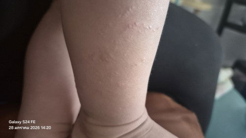 เชื้อราแมว