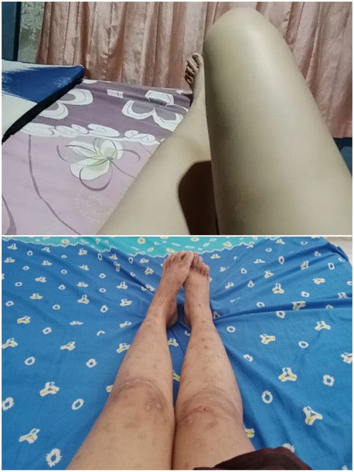 Ada yang sama keluhan hamil ke 3 berubah drastis