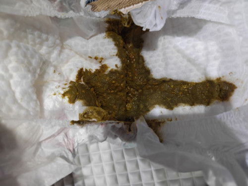 Normal ke poo bayi warna hijau? Bayi saya consume susu fm similac tc. Previous susu s26 Dan Enfalac