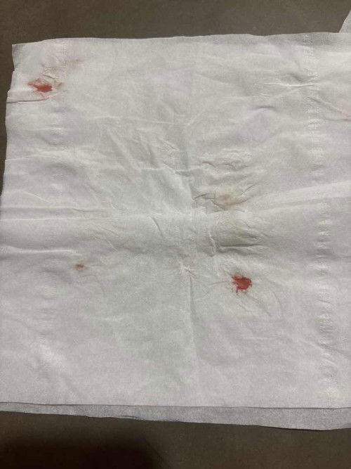 ตั้งครรภ์14สัปดาห์แล้วมีเลือดออก