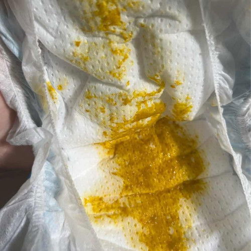 น้องอึไม่มีกากแบบนี้ปกติไหมคะ