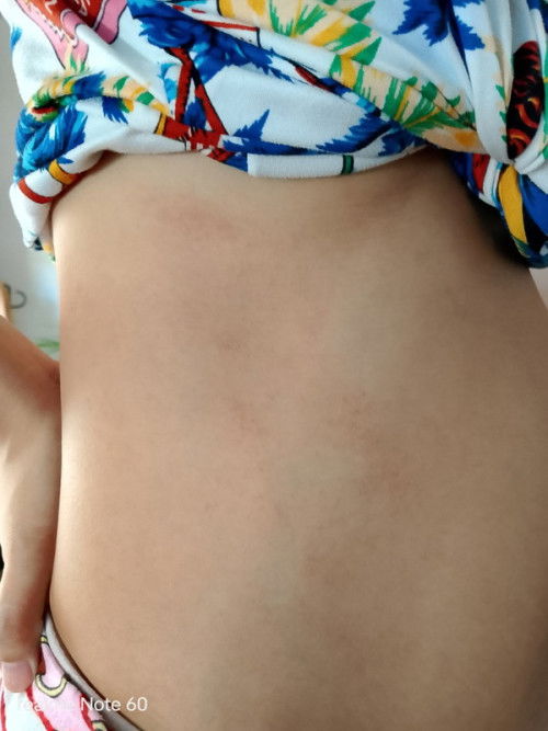 Kati kati o Butlig sa tummy.